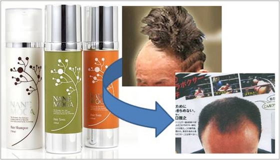 Nanemoga Shampoo (Prevention Hair-loss) 15...